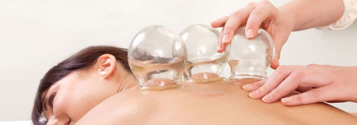 Cupping-Therapy-in-Sammamish-WA Cupping in Sammamish WA